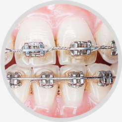 Orthodontic Emergency Care 