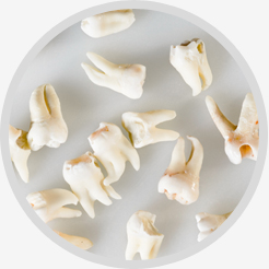 Knocked Out Teeth Repair